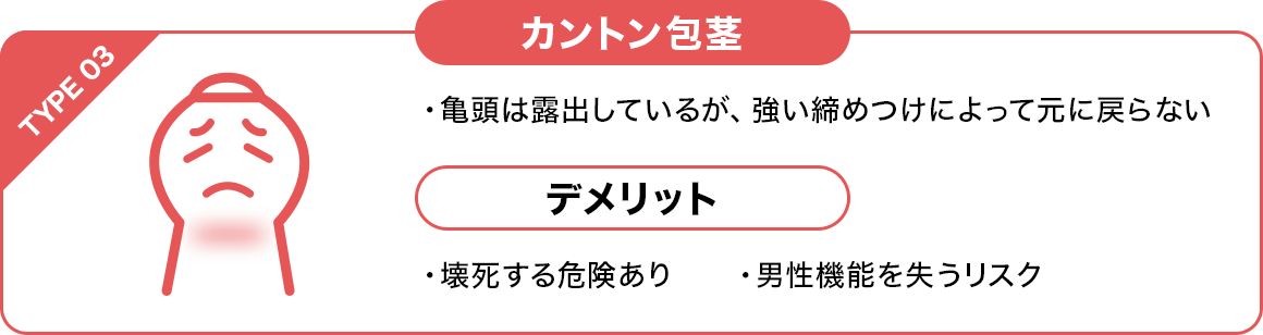 カントン包茎